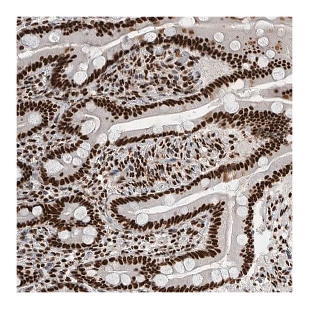 Merck Anti-NCL antibody produced in rabbit