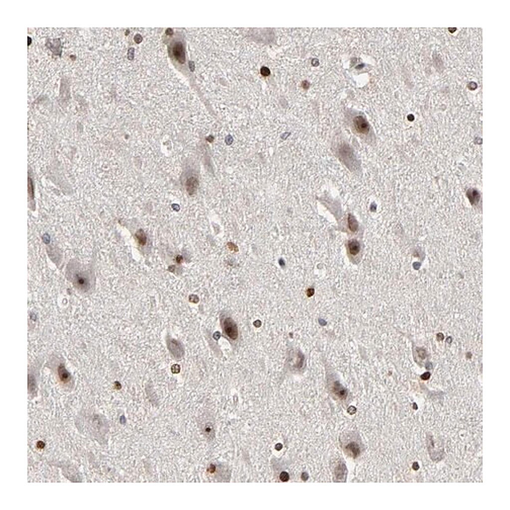 Merck Anti-CPN2 antibody produced in rabbit