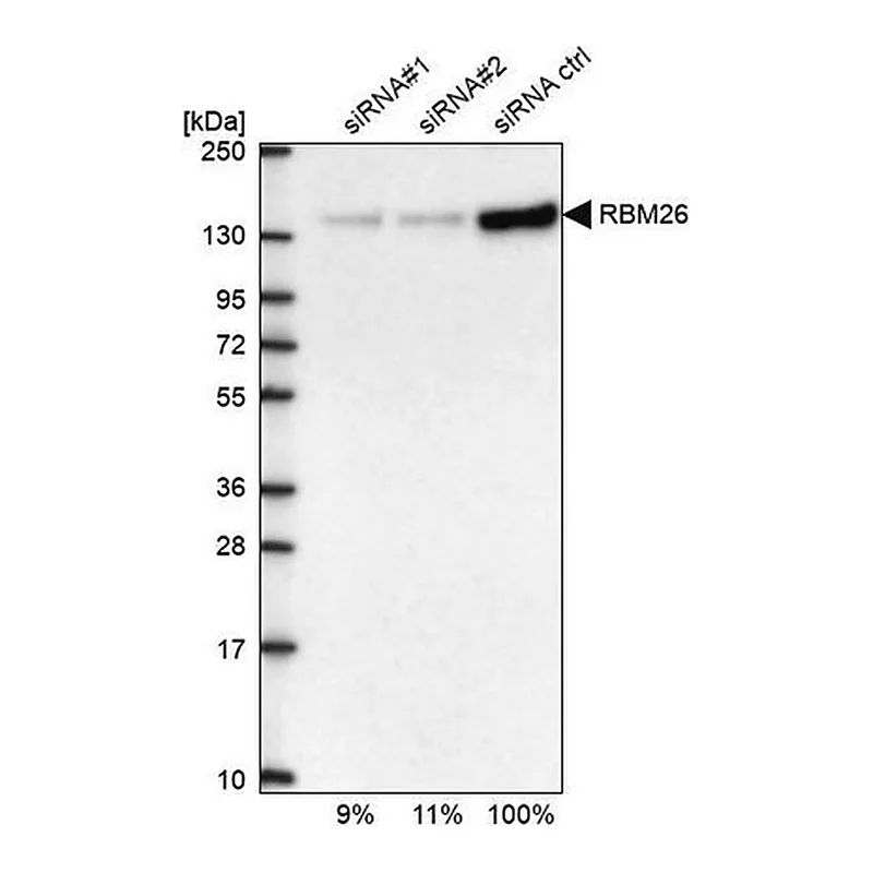 Merck Anti-RBM26 antibody produced in rabbit