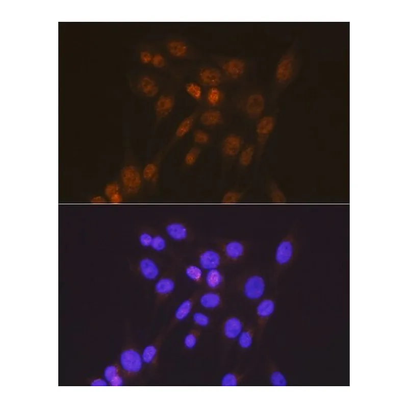 Merck Anti- Smad2 antibody produced in rabbit