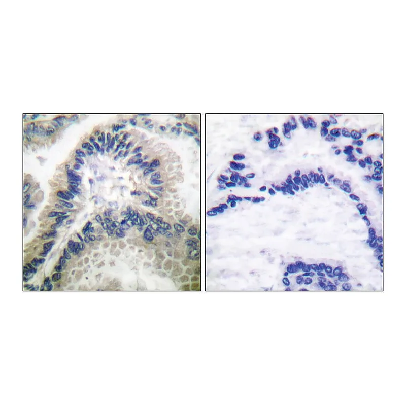 Merck Anti-Guanylate Cyclase beta antibody produced in rabbit