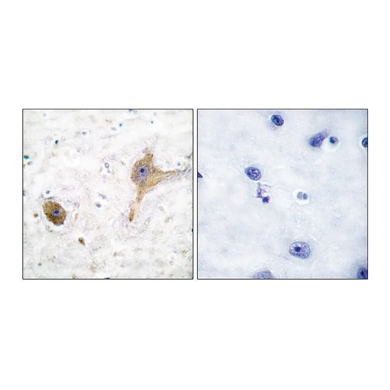 Merck Anti-GABA-B Receptor antibody produced in rabbit