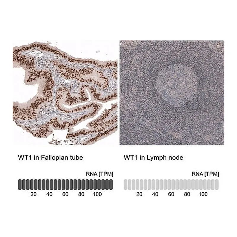 Merck Anti-WT1 antibody produced in mouse