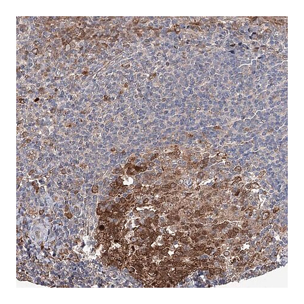 Merck Anti-NCAPD2 antibody produced in rabbit
