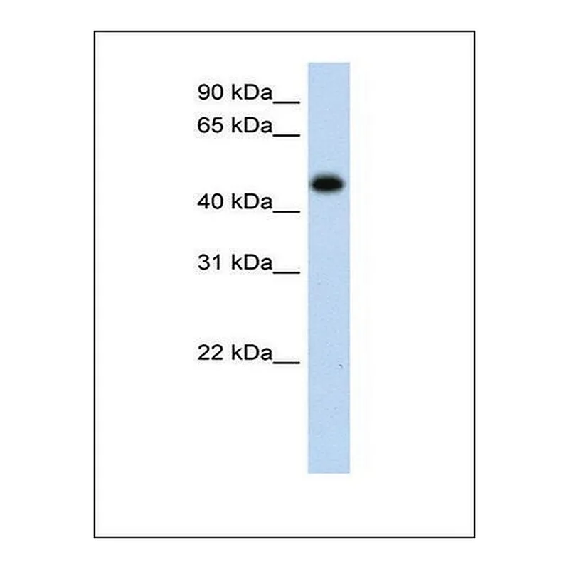 Merck Anti-HAO1 antibody produced in rabbit
