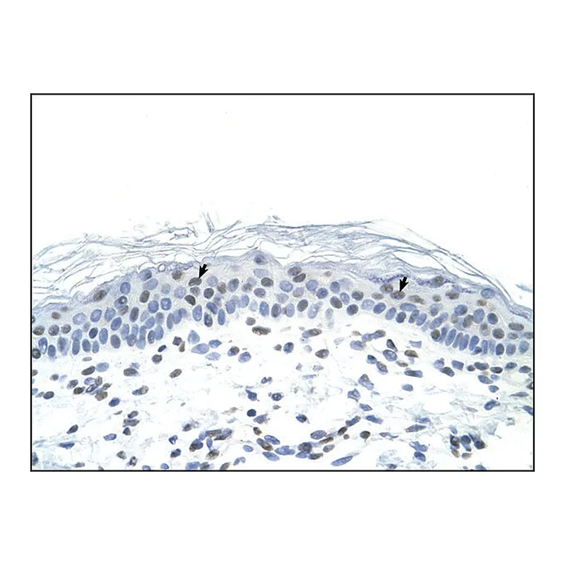 Merck Anti-FOSL1