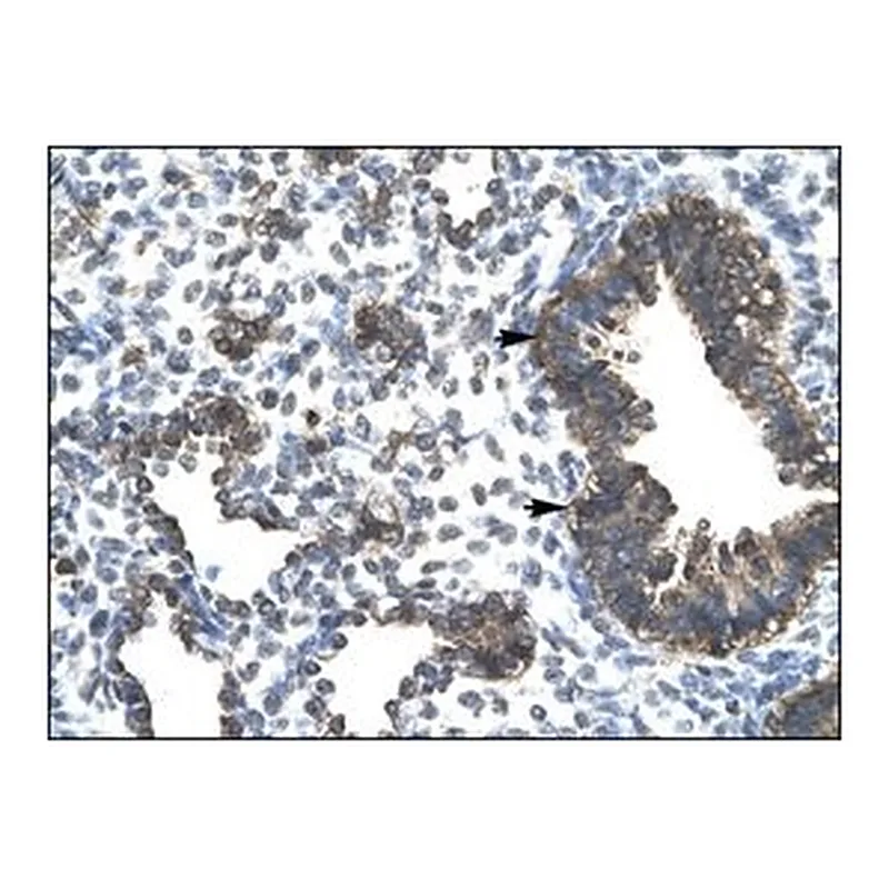 Merck Anti-ESRRG