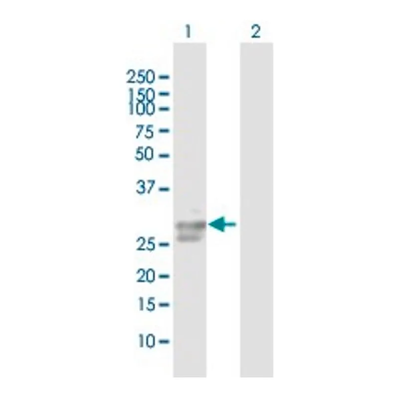 Merck Anti-ULBP2 antibody produced in mouse