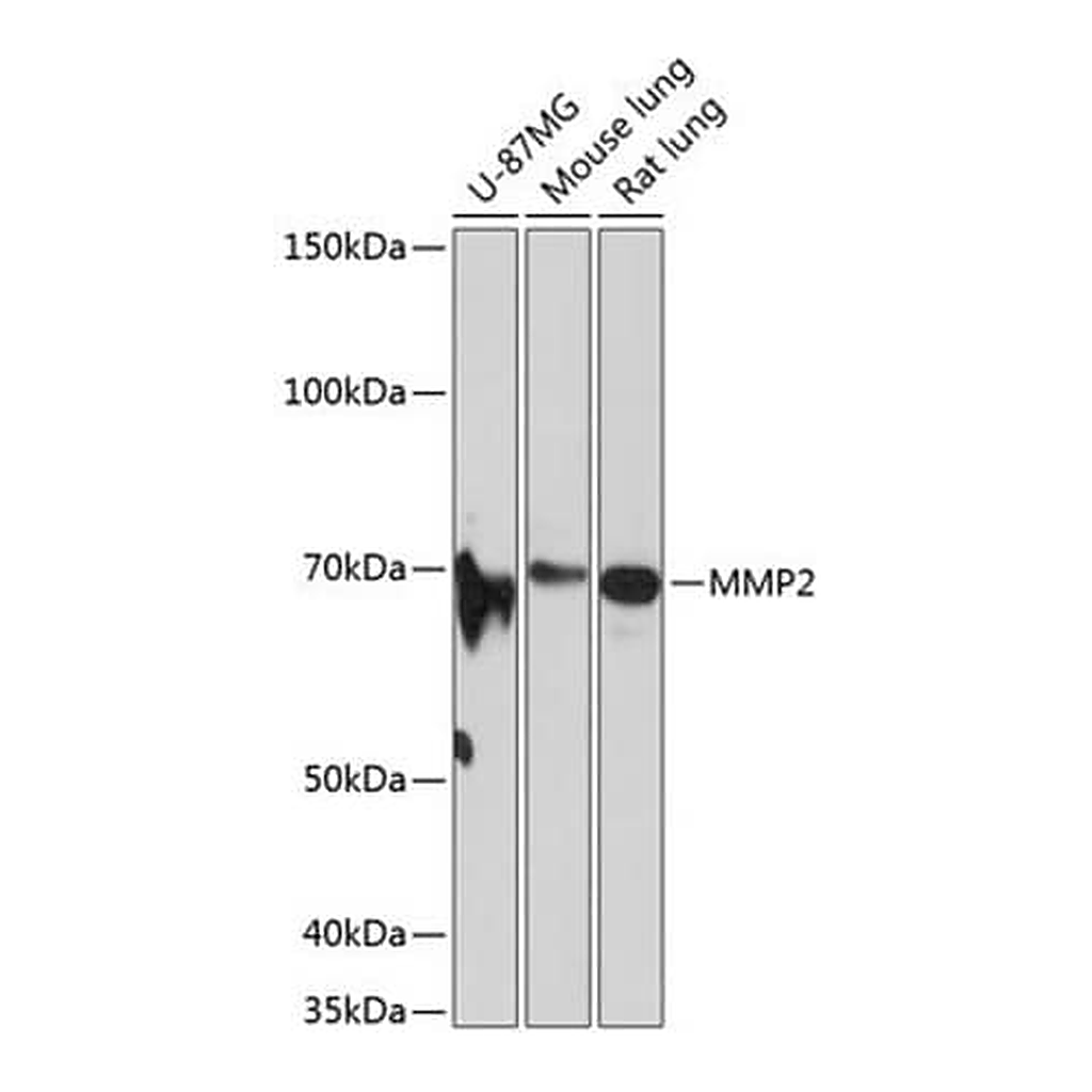 Merck Anti- MMP2 antibody produced in rabbit