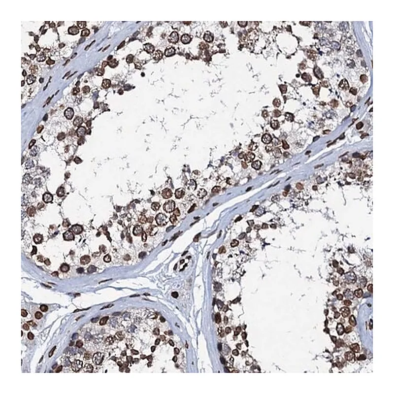 Merck Anti-KATNAL2 antibody produced in rabbit
