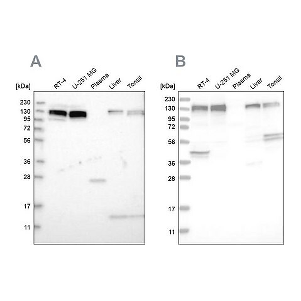 Merck Anti-ERC1 antibody produced in rabbit