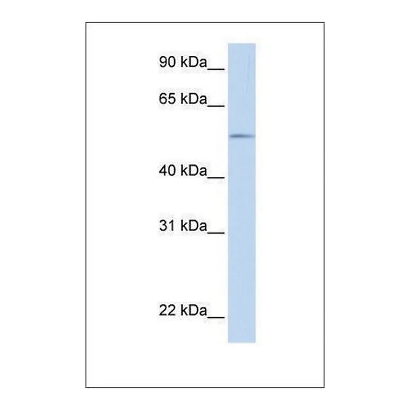 Merck Anti-UGT1A1
