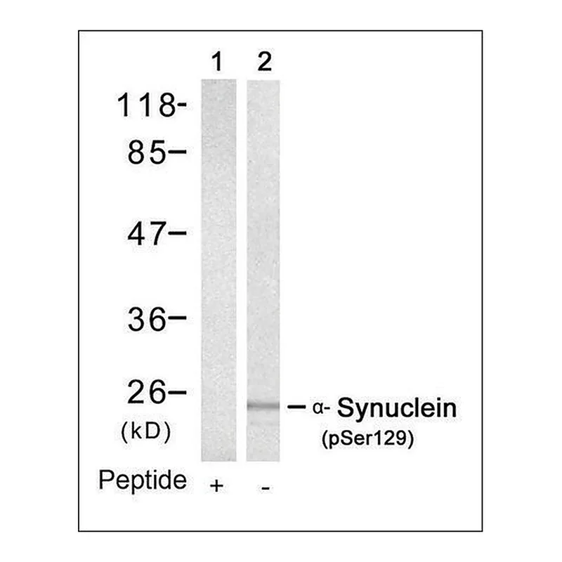 Merck Anti-phospho-SNCA (pSer129) antibody produced in rabbit