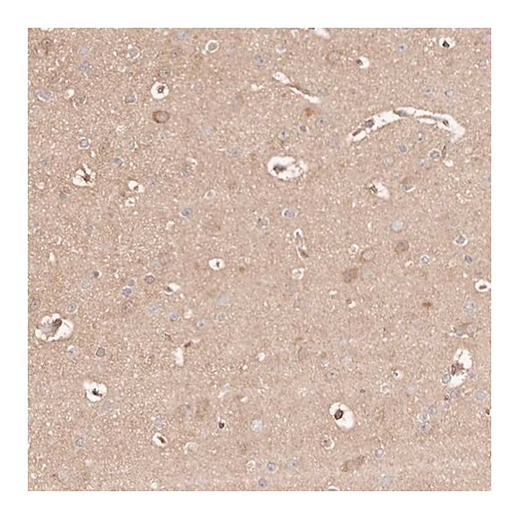 Merck Anti-MAPK1 antibody produced in rabbit