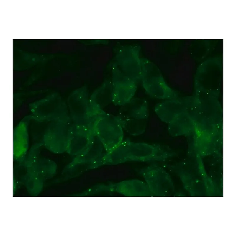 Merck Anti-Perilipin A antibody produced in rabbit