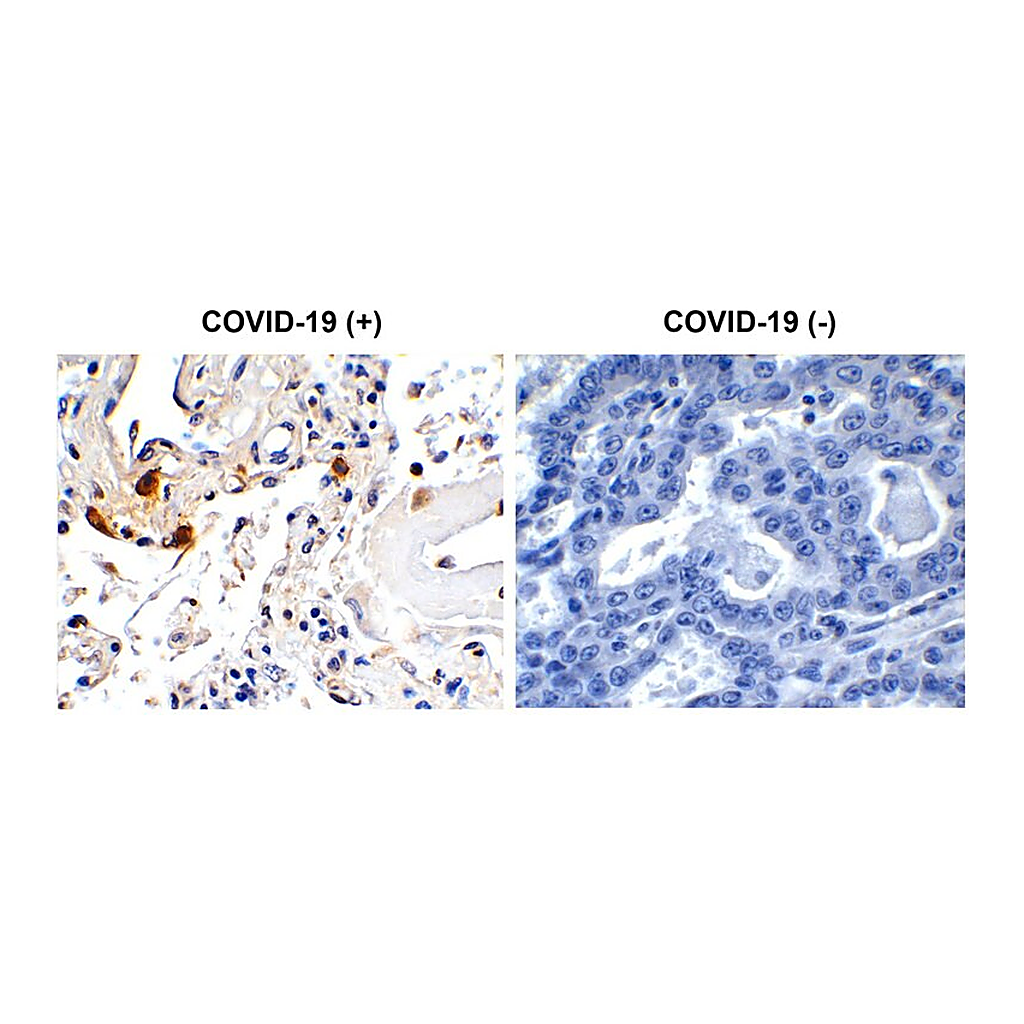 Merck Anti-SARS-CoV-2 (COVID-19, 2019-nCoV) Envelope antibody produced in rabbit