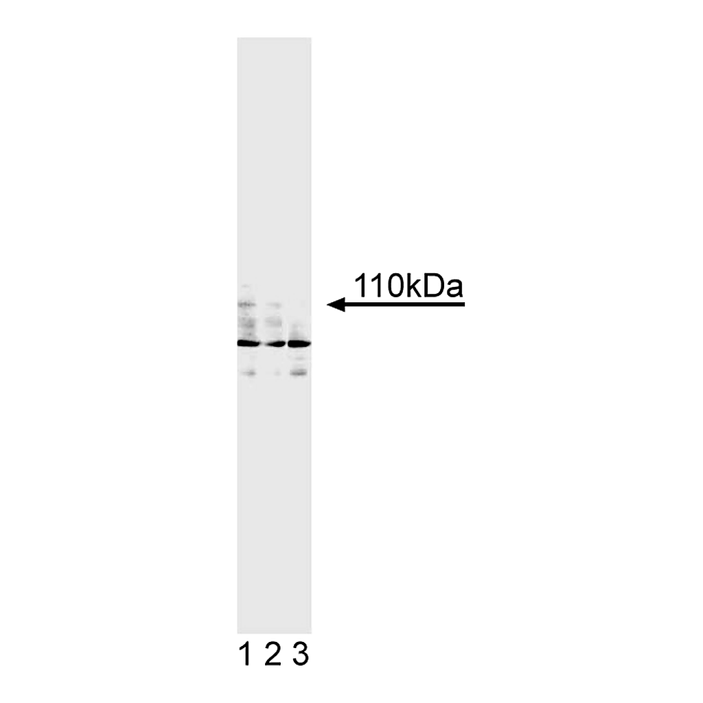 BD Purified Mouse Anti-Human Androgen Receptor