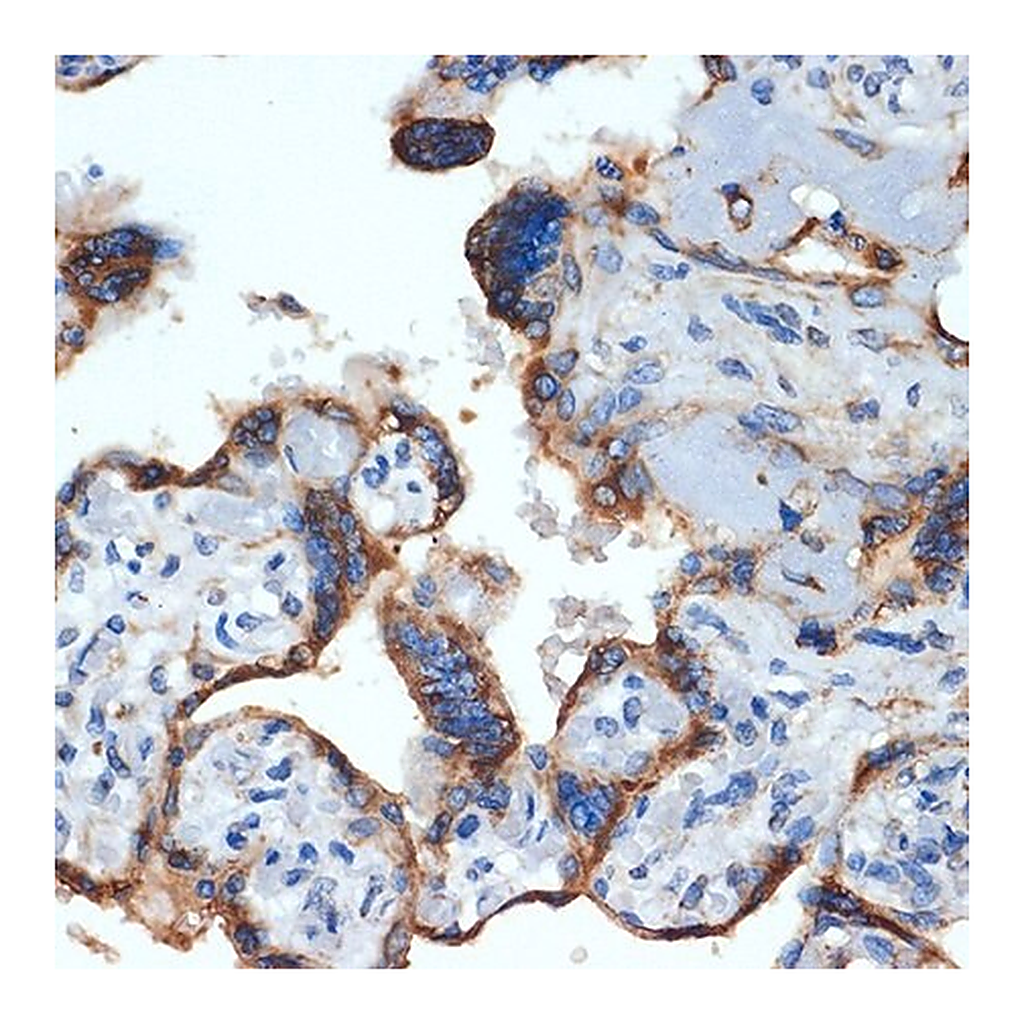 Merck Anti-NLK antibody produced in rabbit