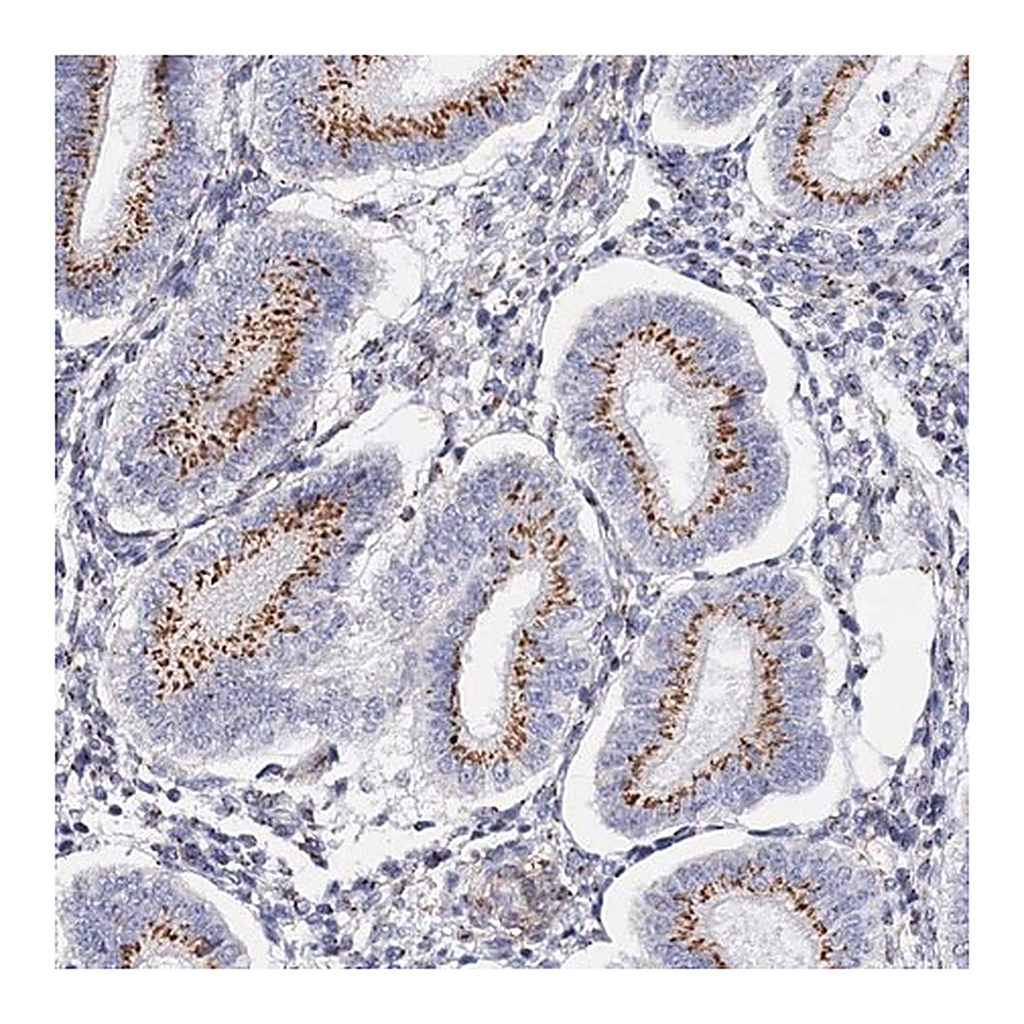 Merck Anti-C11orf96 antibody produced in rabbit