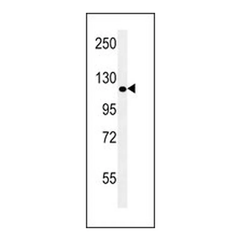 Merck ANTI-POTEE (CENTER)