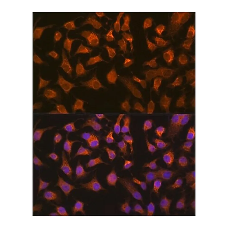 Merck Anti-PEPCK/PCK2 antibody produced in rabbit