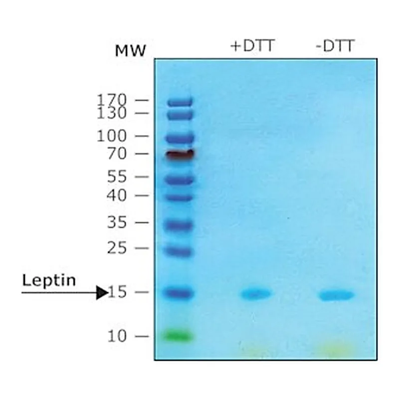 Merck LEPTIN HUMAN,>=97% (SDS-PAGE), RECOMBINA