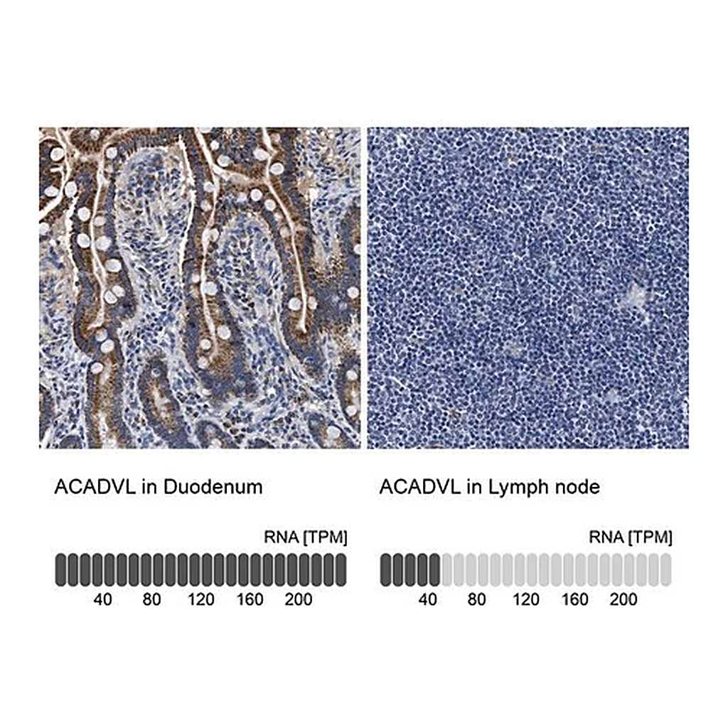 Merck Anti-ACADVL antibody produced in rabbit