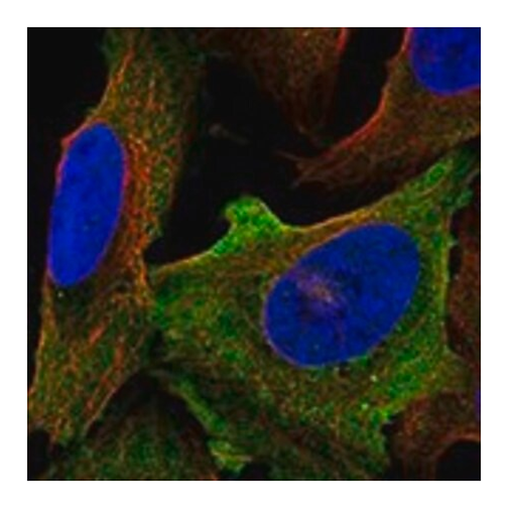 Merck Anti-SCN8A antibody produced in rabbit