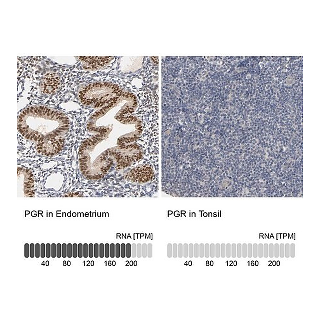 Merck Anti-PGR antibody produced in rabbit