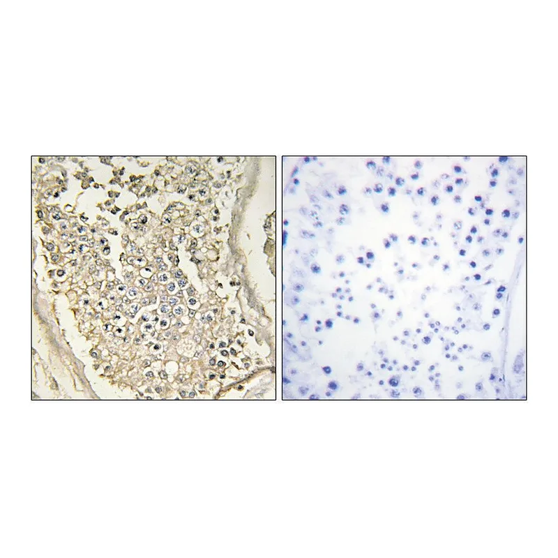 Merck Anti-ATP7B antibody produced in rabbit