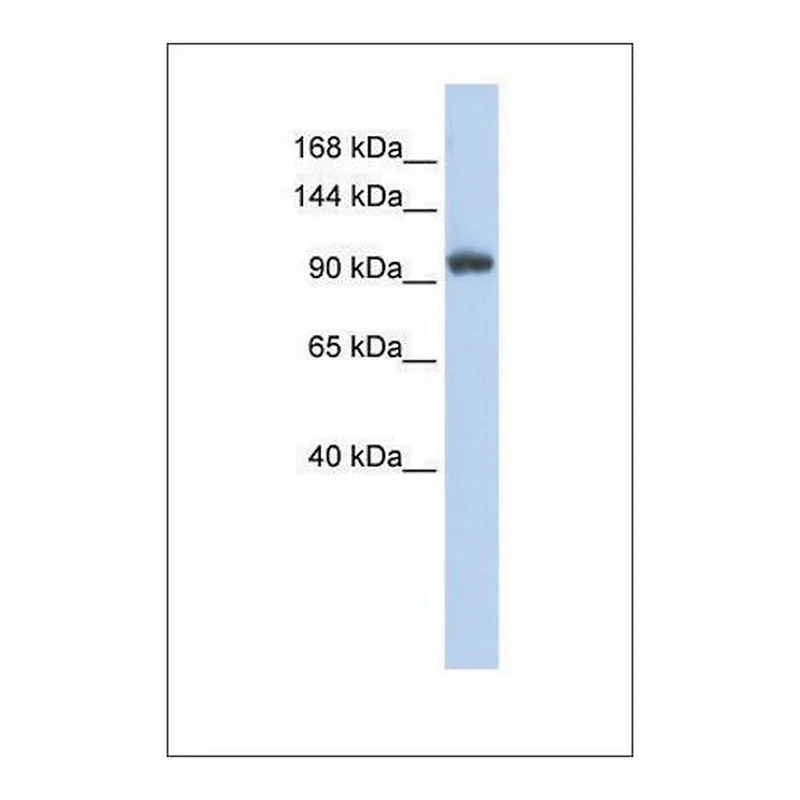 Merck Anti-RNF31 antibody produced in rabbit