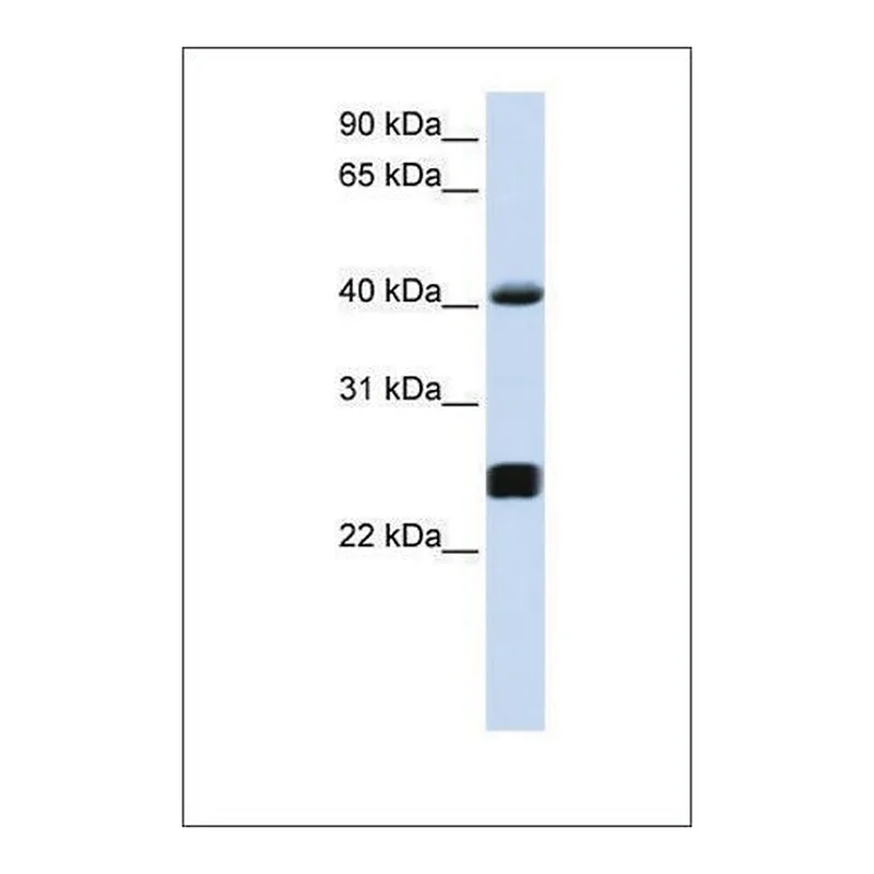 Merck Anti-SERPINA3 antibody produced in rabbit