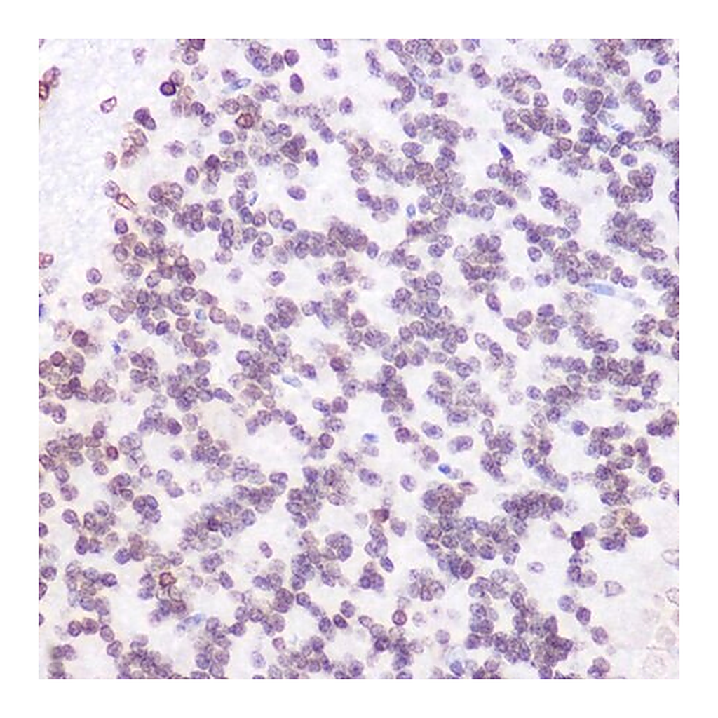 Merck Anti- JMJD6 antibody produced in rabbit