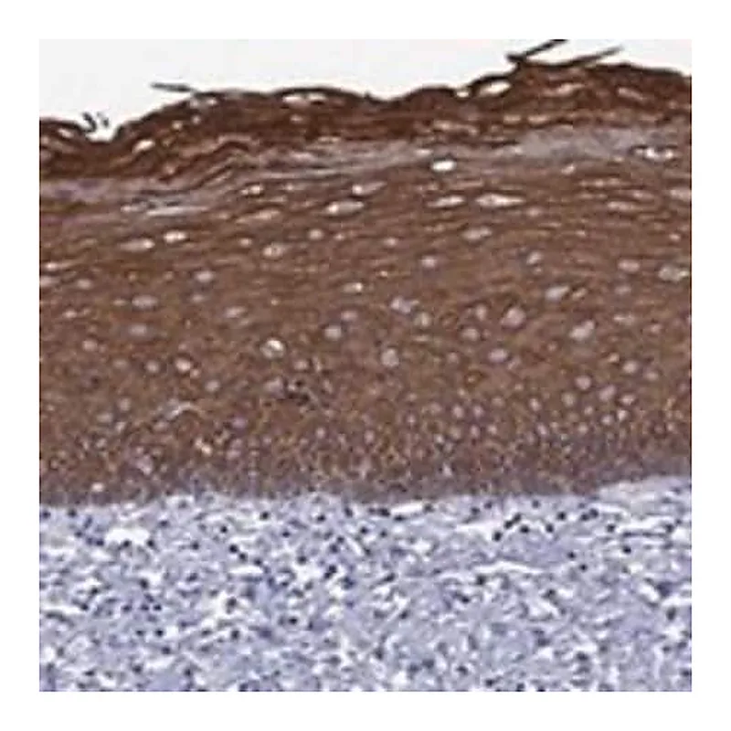 Merck Anti-TMPRSS11A antibody produced in rabbit