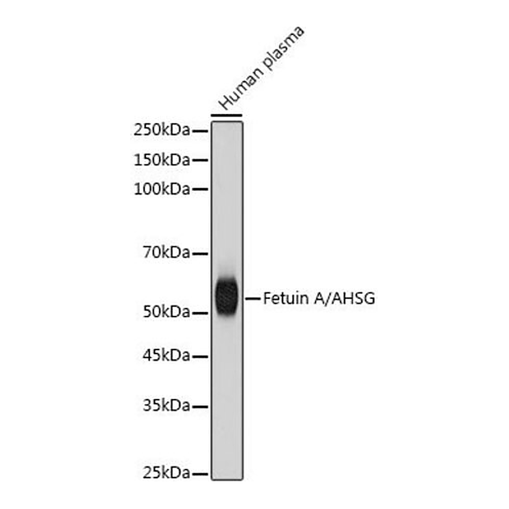 Merck Anti-Fetuin A/AHSG antibody produced in rabbit