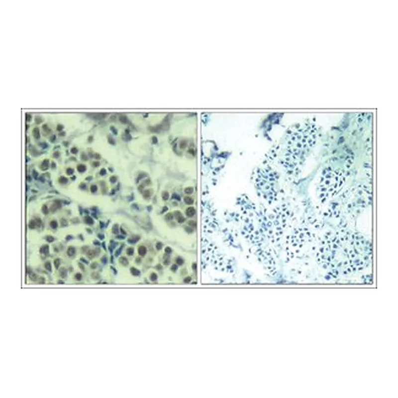 Merck ANTI-MDM2 (AB-166)
