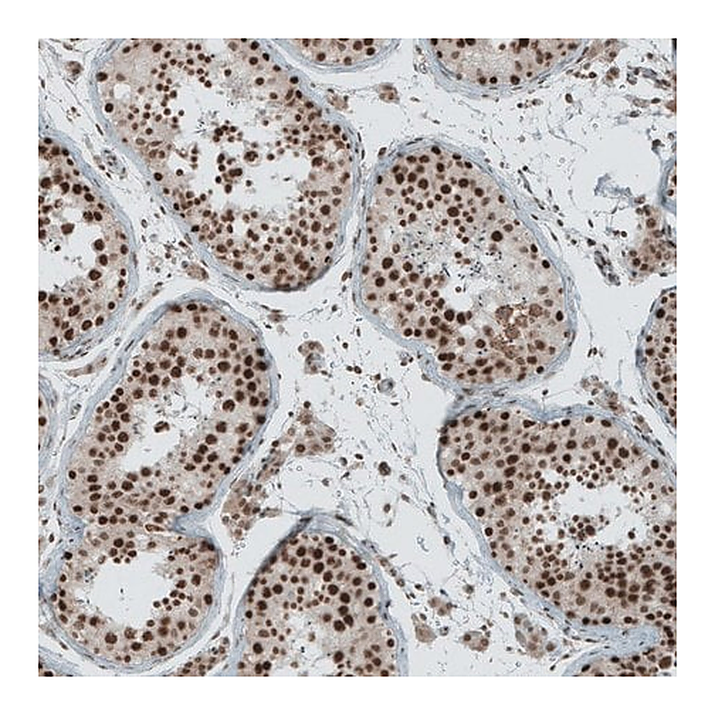 Merck Anti-SENP1 antibody produced in rabbit