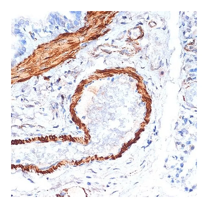 Merck Anti-alpha-Actin-1 (ATCA1) antibody produced in rabbit