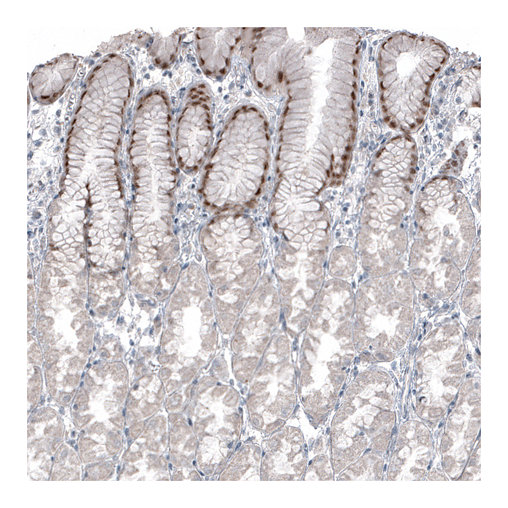 Atlas Antibodies Anti-SOX21 Antibody