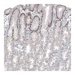 Atlas Antibodies Anti-SOX21 Antibody