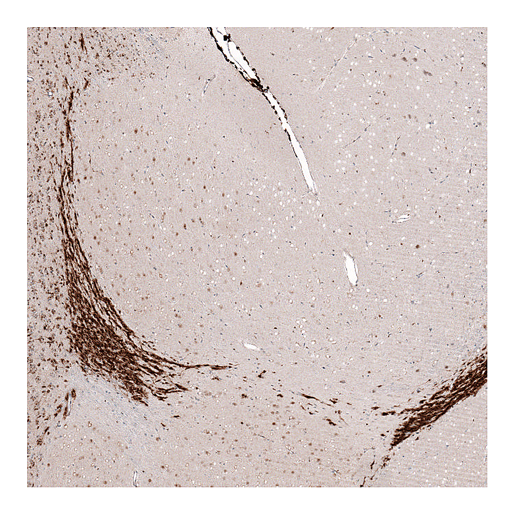 Atlas Antibodies Anti-SOX4 Antibody