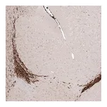 Atlas Antibodies Anti-SOX4 Antibody