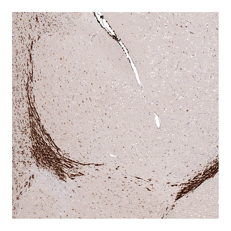 Atlas Antibodies Anti-SOX4 Antibody