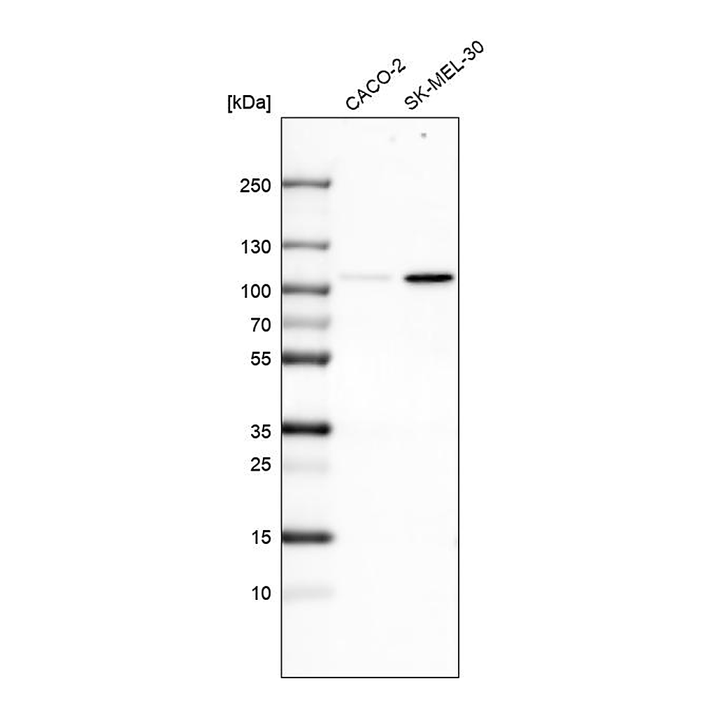 Atlas Antibodies Anti-SOX6 Antibody