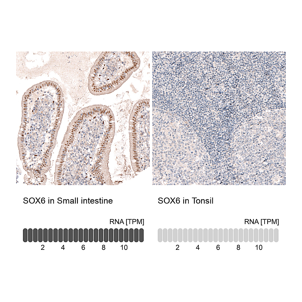 Atlas Antibodies Anti-SOX6 Antibody