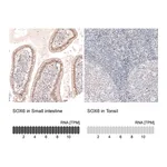 Atlas Antibodies Anti-SOX6 Antibody