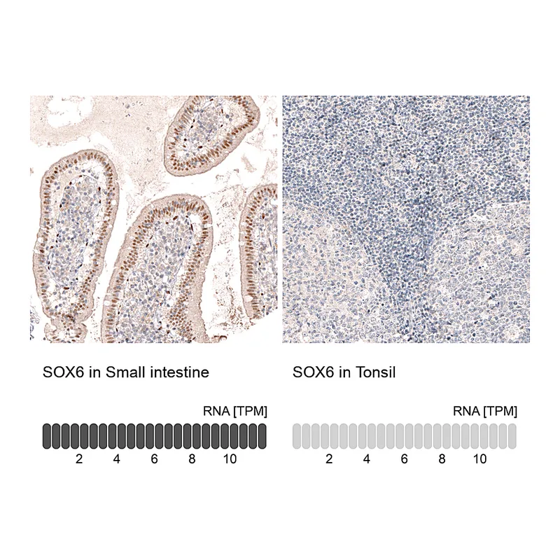 Atlas Antibodies Anti-SOX6 Antibody