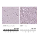 Atlas Antibodies Anti-SOX9 Antibody