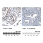 Atlas Antibodies Anti-SPAG5 Antibody