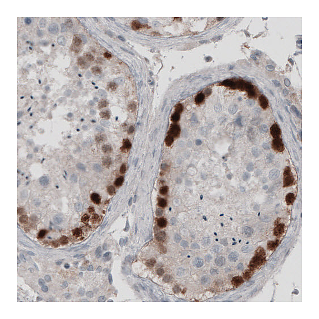 Atlas Antibodies Anti-SSX2 Antibody